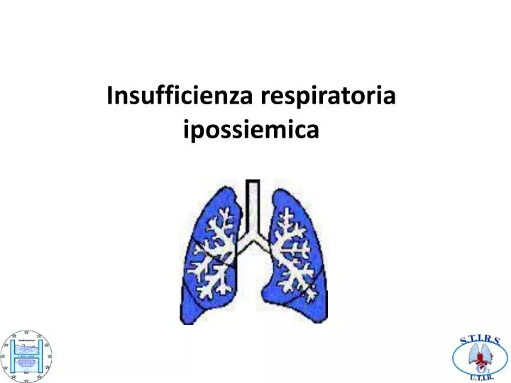 insufficienza respiratoria ipossiemica