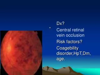 Dx? Central retinal vein occlusion Risk factors? Coagebility disorder,HpT,Dm,age.