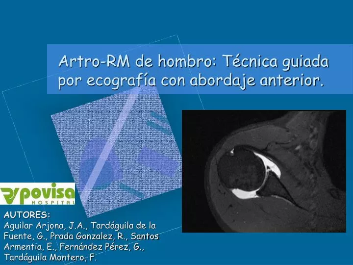 artro rm de hombro t cnica guiada por ecograf a con abordaje anterior