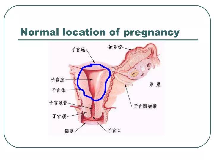 normal location of pregnancy