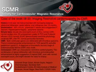 Case of the week 08-20: Imaging Restrictive cardiomyopathy by CMR