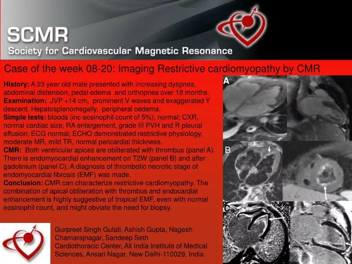 case of the week 08 20 imaging restrictive cardiomyopathy by cmr