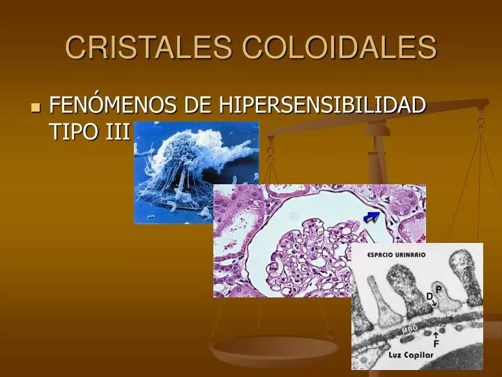 cristales coloidales