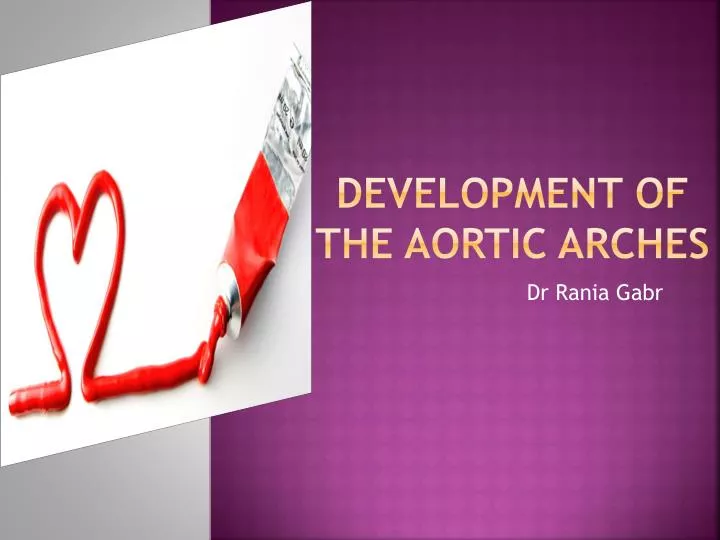 development of the aortic arches