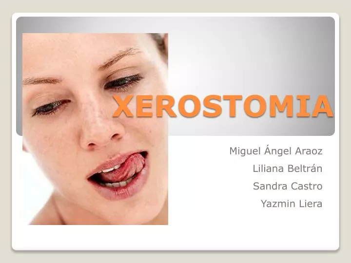 PPT - XEROSTOMIA PowerPoint Presentation, Free Download - ID:5399743