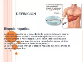definici n