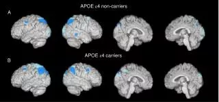 APOE ? 4 non-carriers