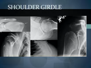 Shoulder girdle