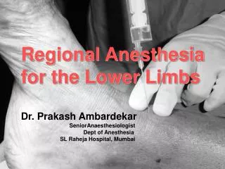Regional Anesthesia for the Lower Limbs Dr. Prakash Ambardekar SeniorAnaesthesiologist