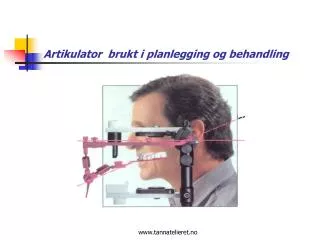artikulator brukt i planlegging og behandling