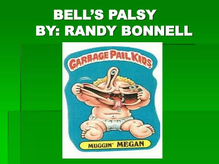 bell s palsy by randy bonnell