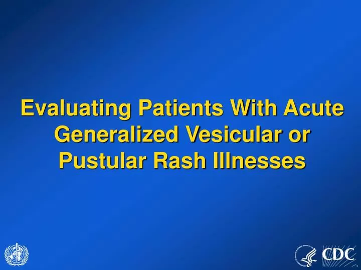 evaluating patients with acute generalized vesicular or pustular rash illnesses