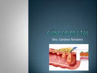 c ncer rectal