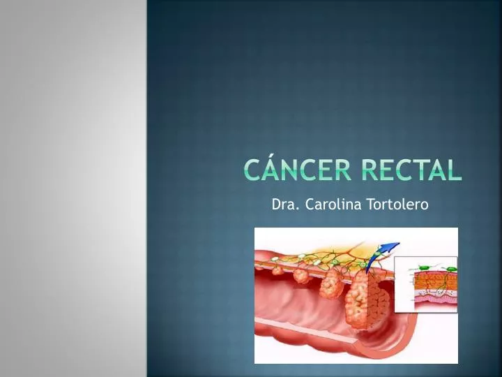 Ppt Cáncer Rectal Powerpoint Presentation Free Download Id5431034