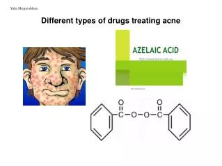 Different types of drugs treating acne