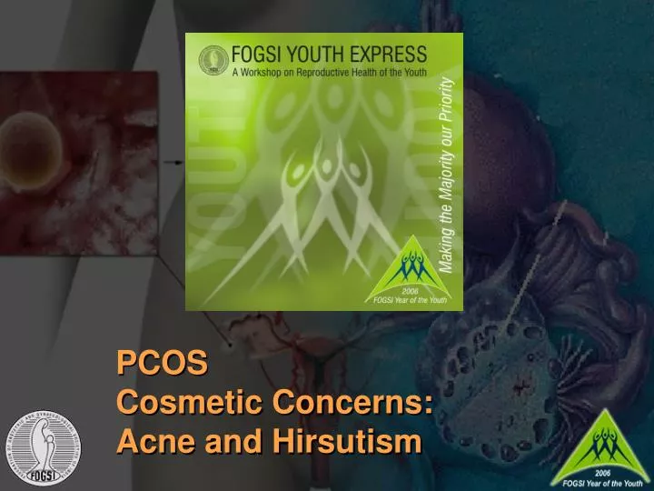 pcos cosmetic concerns acne and hirsutism