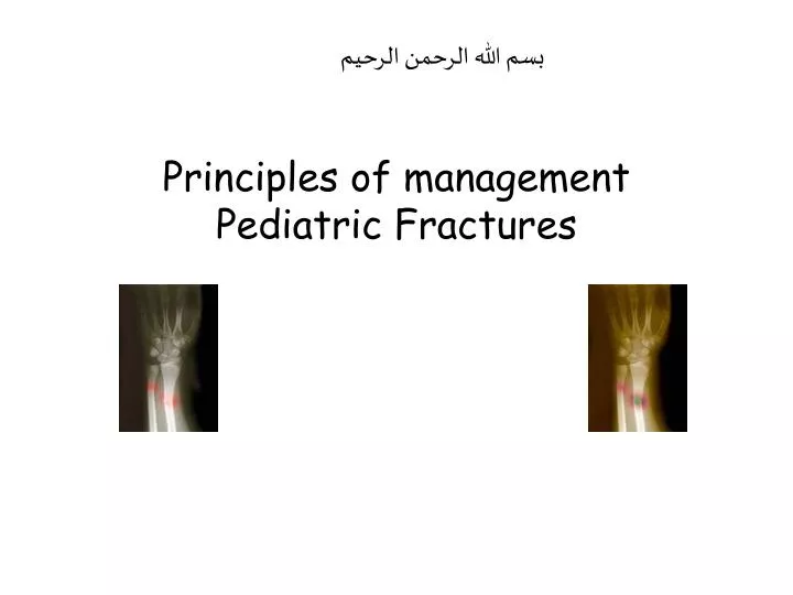 principles of management pediatric fractures
