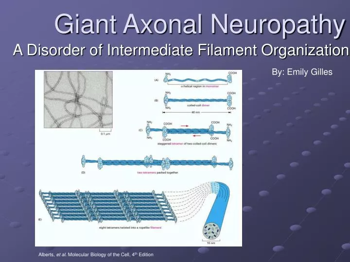 giant axonal neuropathy