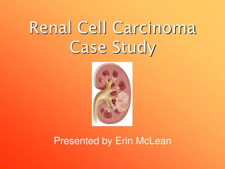 renal cell carcinoma case study
