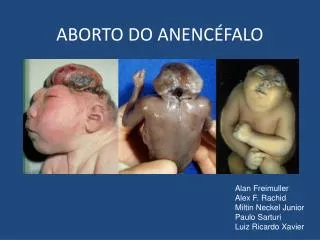 aborto do anenc falo