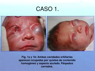 caso 1