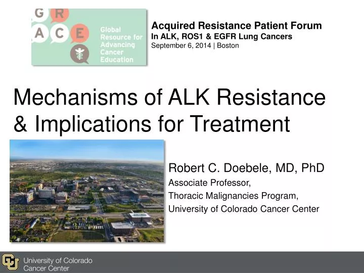 mechanisms of alk resistance implications for treatment