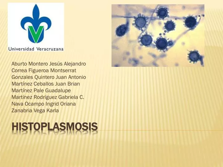 histoplasmosis