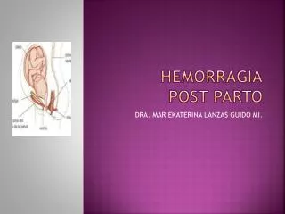 hemorragia post parto