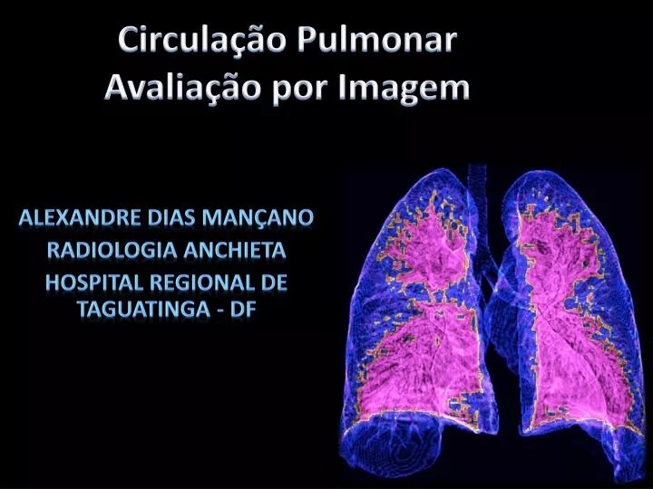 circula o pulmonar avalia o por imagem