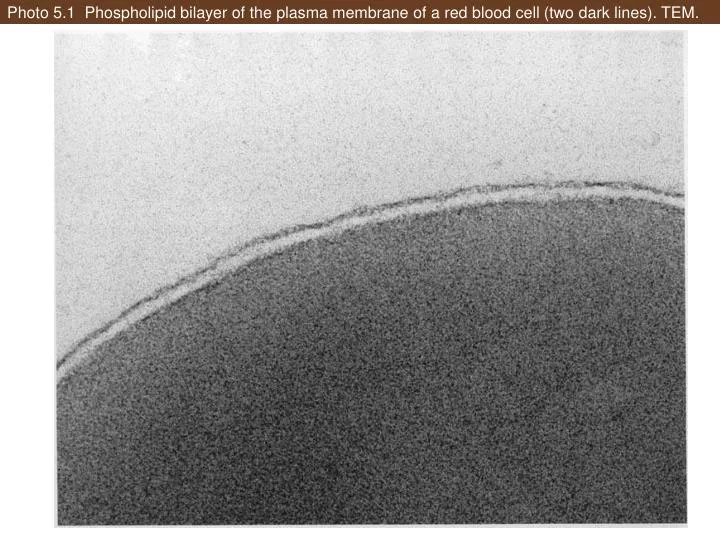 photo 5 1 phospholipid bilayer of the plasma membrane of a red blood cell two dark lines tem
