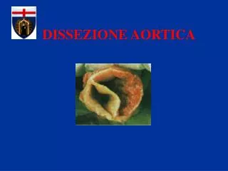 dissezione aortica