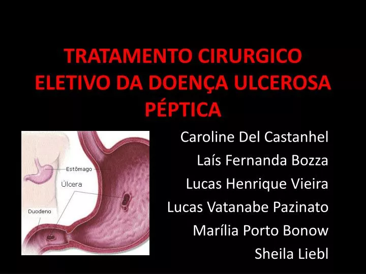 tratamento cirurgico eletivo da doen a ulcerosa p ptica