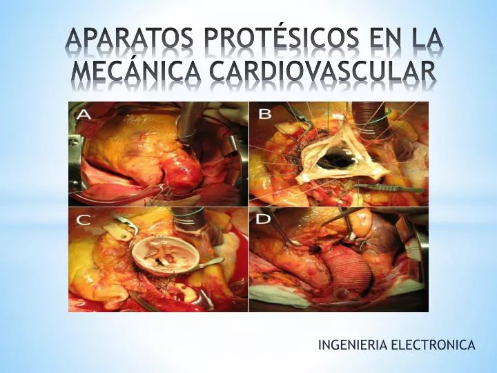 aparatos prot sicos en la mec nica cardiovascular