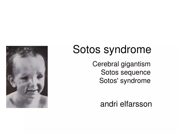 sotos syndrome