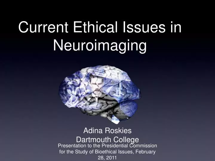 current ethical issues in neuroimaging