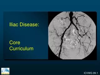 Iliac Disease: Core Curriculum