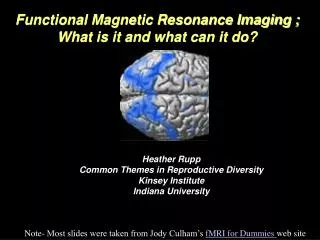 Functional Magnetic Resonance Imaging ; What is it and what can it do?