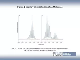 Figure 2 Capillary electrophoresis of an MSI cancer