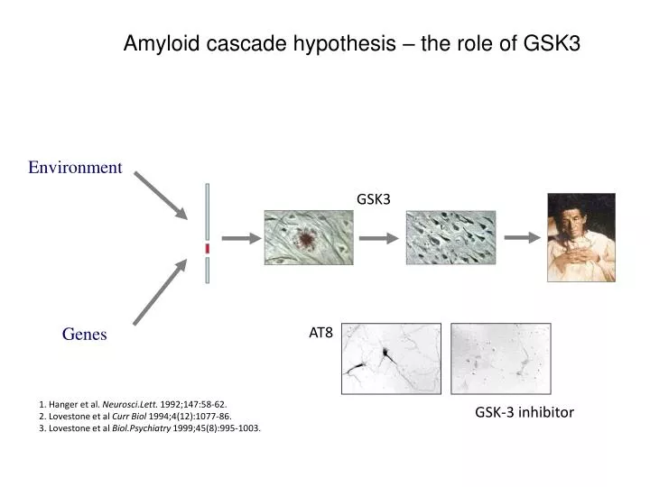 amyloid cascade hypothesis the role of gsk3