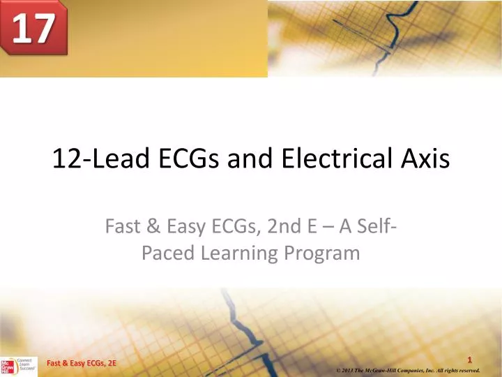12 lead ecgs and electrical axis