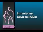 IUD Safety - slide 1