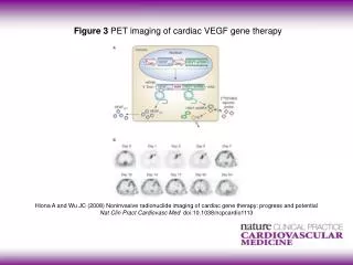 Figure 3 PET imaging of cardiac VEGF gene therapy