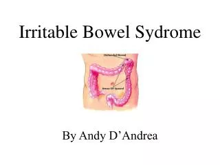 Irritable Bowel Sydrome