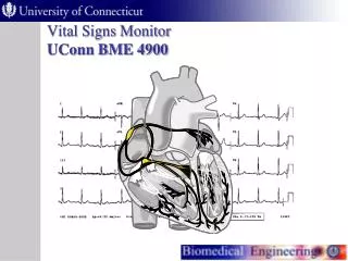 Vital Signs Monitor UConn BME 4900