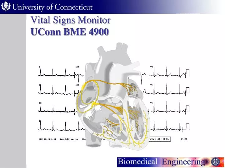 vital signs monitor uconn bme 4900