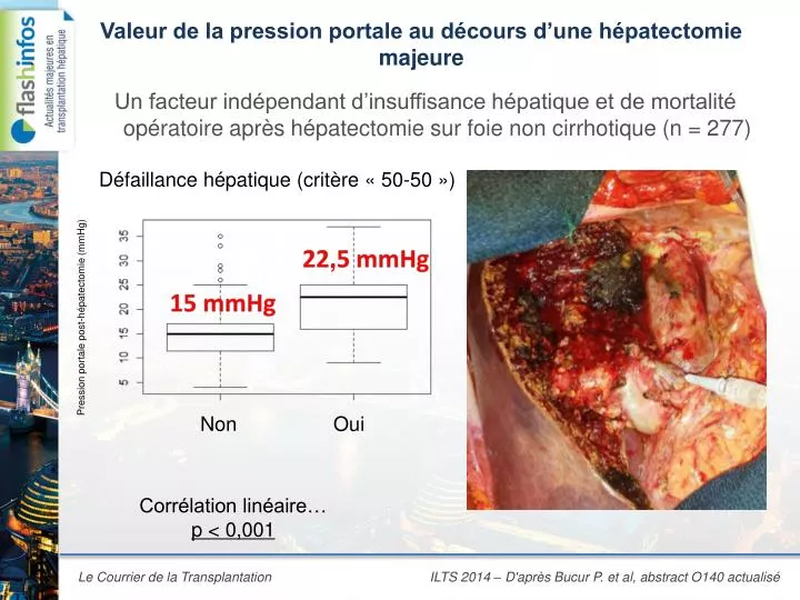 valeur de la pression portale au d cours d une h patectomie majeure