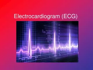 Electrocardiogram (ECG)