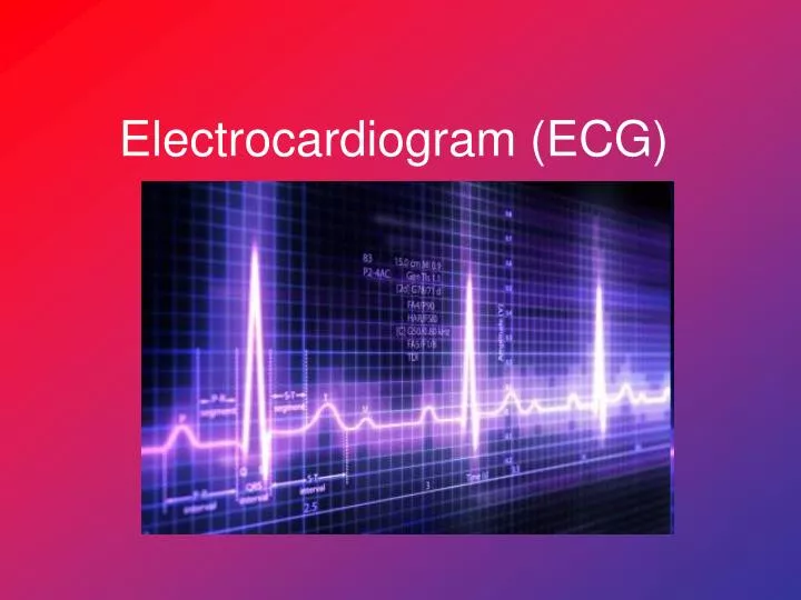 electrocardiogram ecg