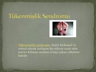 t kenmi lik sendromu
