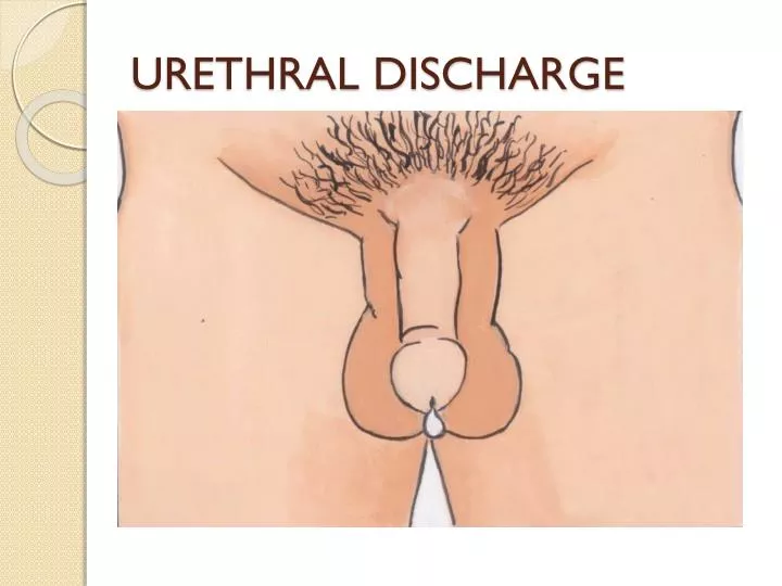 urethral discharge